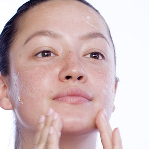 Clarity Acid Peel